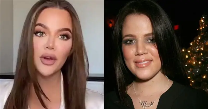 Khloé Kardashian Face